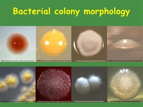 IDENTIFICATION OF BACTERIA BELONGING TO THE .